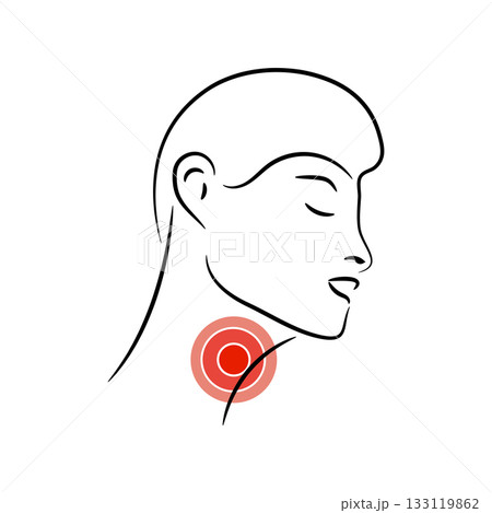 Sore Throat vector illustration. Feeling pain in throat. Logo design 133119862