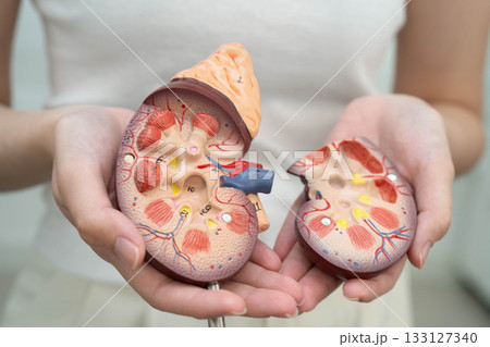 Chronic kidney disease, Asian woman with model for treatment urinary system, urology, Estimated glomerular filtration rate eGFR. 133127340