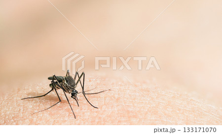 Macro shot of mosquito biting human skin 133171070