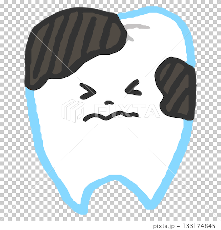 Stained teeth Stained teeth 133174845