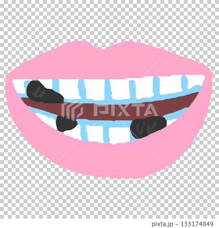A mouth with dirty teeth A mouth with dirty teeth 133174849