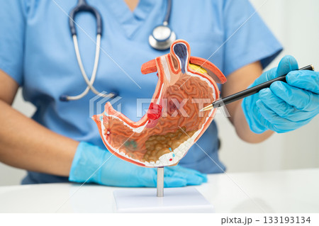 Stomach disease, doctor holding anatomy model for study diagnosis and treatment in hospital. Stomach disease, doctor holding anatomy model for study diagnosis and treatment in hospital. 133193134