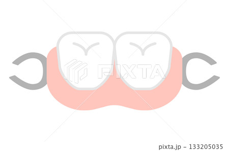 歯の矯正や部分入れ歯のかわいいシンプルな介護イラスト素材 133205035