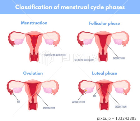 Menstrual cycle phases. Menstruation period uterus ovary infographic chart, follicular ovulation luteal phase progesterone reproductive system education, neat vector illustration 133242885