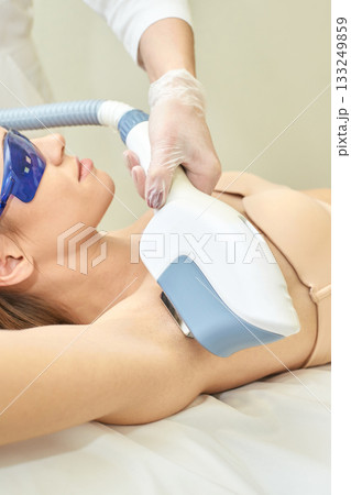 Female receiving laser hair removal treatment in clinic wearing protective 133249859