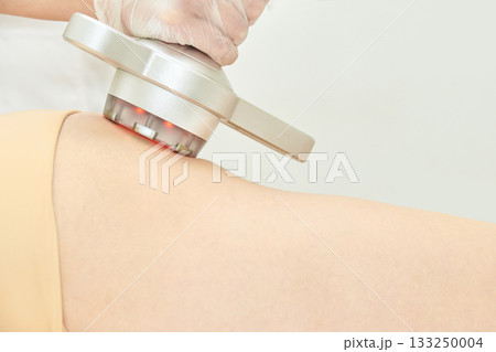 Female adult receiving non-invasive cellulite reduction treatment on thigh 133250004