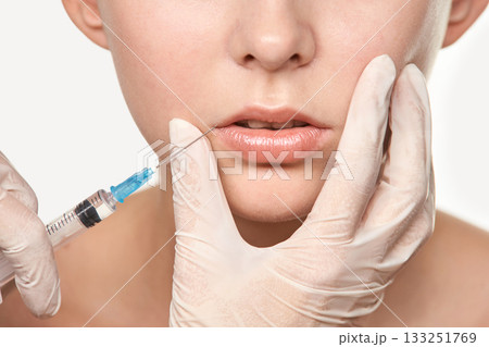 Female adult receiving lip injection treatment with syringe for cosmetic 133251769