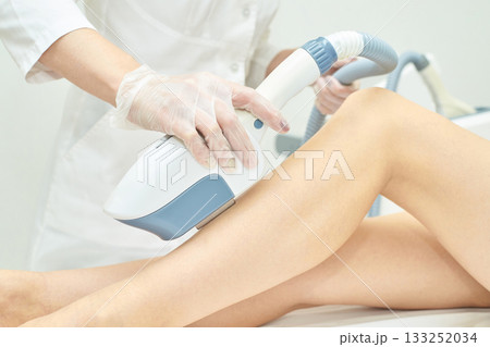 Female professional performing laser hair removal on caucasian woman leg Female professional performing laser hair removal on caucasian woman leg 133252034