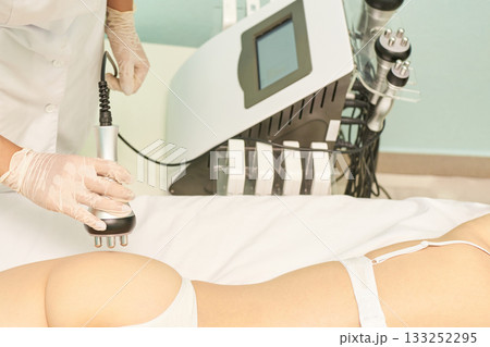 Caucasian female receiving rf cavitation treatment in spa with modern equipment 133252295