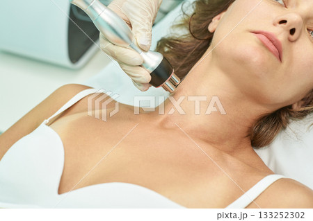 Female receiving radiofrequency facial treatment in spa clinic for skin Female receiving radiofrequency facial treatment in spa clinic for skin 133252302