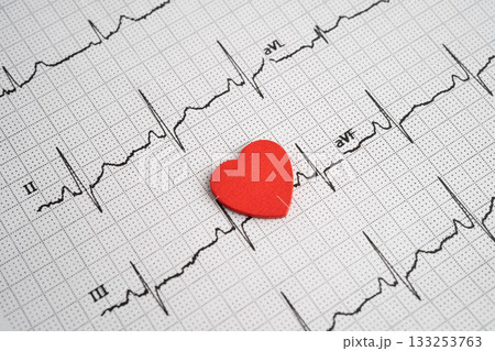 Electrocardiogram ECG, heart wave, heart attack, cardiogram report. Electrocardiogram ECG, heart wave, heart attack, cardiogram report. 133253763