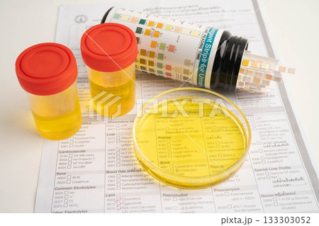 Urinalysis, urine cup with reagent strip pH paper test and comparison chart in laboratory. Urinalysis, urine cup with reagent strip pH paper test and comparison chart in laboratory. 133303052