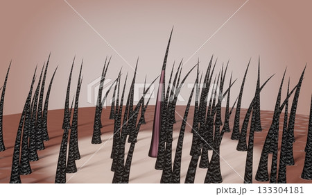 Hair follicles - regeneration concept - 3D illustration 133304181