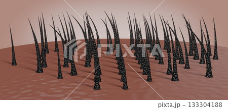 Dried and damaged hair follicles - 3D illustration Dried and damaged hair follicles - 3D illustration 133304188