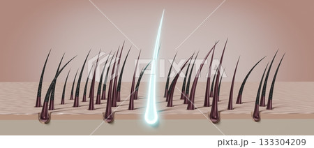 Hair follicles - regeneration concept - 3D illustration Hair follicles - regeneration concept - 3D illustration 133304209