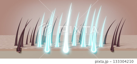 Hair follicles - regeneration concept - 3D illustration Hair follicles - regeneration concept - 3D illustration 133304210