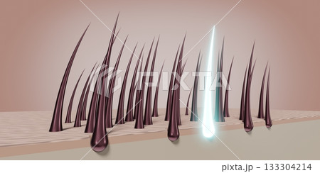 Hair follicles - regeneration concept - 3D illustration Hair follicles - regeneration concept - 3D illustration 133304214