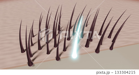 Hair follicles - regeneration concept - 3D illustration Hair follicles - regeneration concept - 3D illustration 133304215