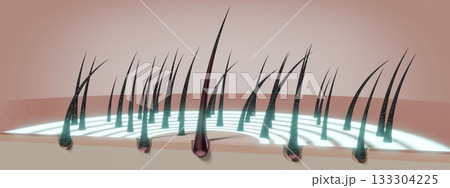 Hair follicles - regeneration concept - 3D illustration Hair follicles - regeneration concept - 3D illustration 133304225