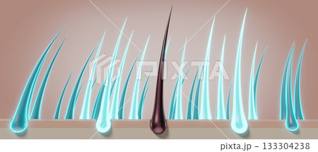 Hair follicles - regeneration concept - 3D illustration 133304238