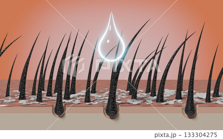 Hair follicles and shampoo treatment against dandruff - 3D illustration Hair follicles and shampoo treatment against dandruff - 3D illustration 133304275