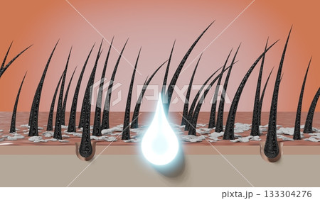 Hair follicles and shampoo treatment against dandruff - 3D illustration 133304276