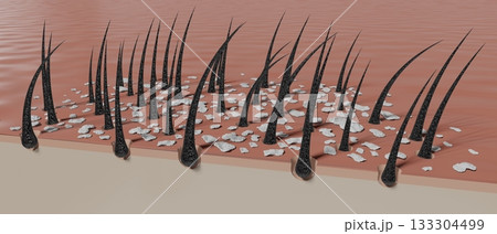 Hair follicles and dandruff under microscope - 3D illustration 133304499