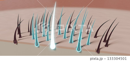 Hair follicles - regeneration concept - 3D illustration 133304501