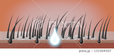Hair follicles and shampoo treatment against dandruff - 3D illustration Hair follicles and shampoo treatment against dandruff - 3D illustration 133304507
