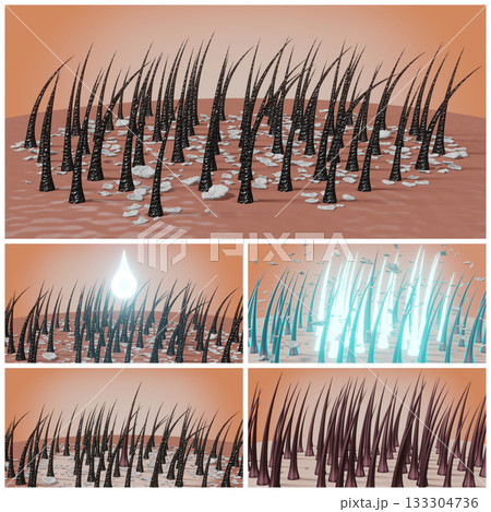 Hair follicles and dandruff - steps in therapy - 3D illustration 133304736