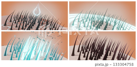 Hair follicles and dandruff - steps in therapy - 3D illustration 133304758