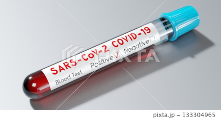Coronavirus, SARS CoV 2, Covid 19 virus - test tube, blood test - 3D illustration Coronavirus, SARS CoV 2, Covid 19 virus - test tube, blood test - 3D illustration 133304965