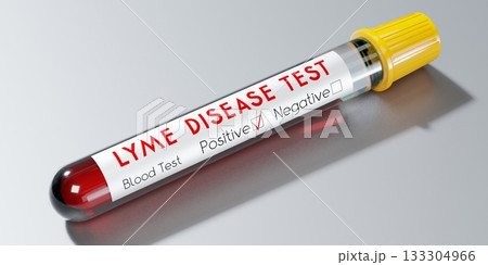 Lyme disease virus - test tube, blood test - 3D illustration Lyme disease virus - test tube, blood test - 3D illustration 133304966