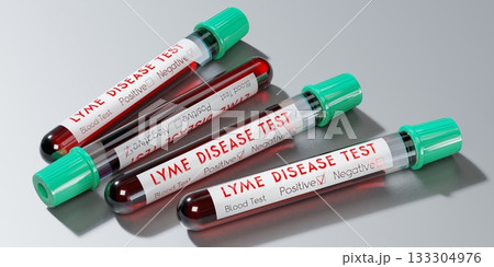 Lyme disease virus - test tubes, blood tests - 3D illustration Lyme disease virus - test tubes, blood tests - 3D illustration 133304976