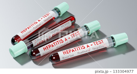 Hepatitis A virus - test tubes, blood tests - 3D illustration 133304977