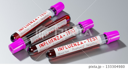 Influenza virus - test tubes, blood tests - 3D illustration 133304980