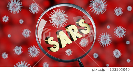 SARS virus concept, magnifying glass - 3D illustration 133305049