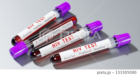 HIV virus, AIDS - test tubes, blood tests - 3D illustration 133305080