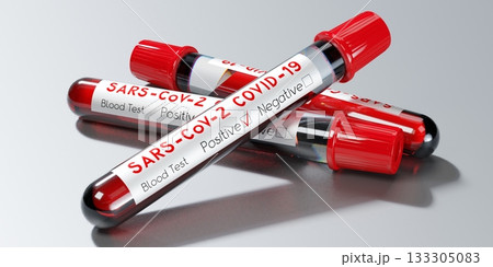 Coronavirus, SARS CoV 2, Covid 19 virus - test tubes, blood tests - 3D illustration 133305083