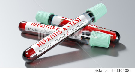 Hepatitis A virus - test tubes, blood tests - 3D illustration Hepatitis A virus - test tubes, blood tests - 3D illustration 133305086