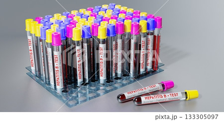 Hepatitis B virus - test tubes, blood tests - 3D illustration 133305097