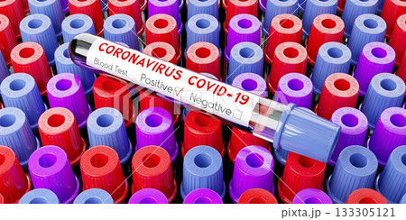Coronavirus, SARS CoV 2, Covid 19 virus - test tubes, blood tests - 3D illustration Coronavirus, SARS CoV 2, Covid 19 virus - test tubes, blood tests - 3D illustration 133305121