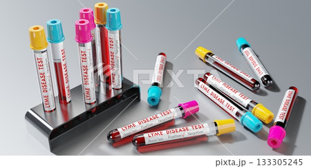 Lyme disease virus - test tubes, blood tests - 3D illustration 133305245