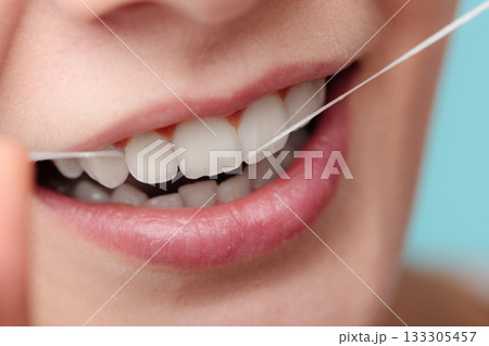 Woman smiling with dental floss. 133305457