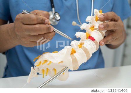 Asian doctor holding spinal nerve and bone model, Lumbar spine displaced herniated disc fragment for treatment medical in the orthopedic department. 133341403