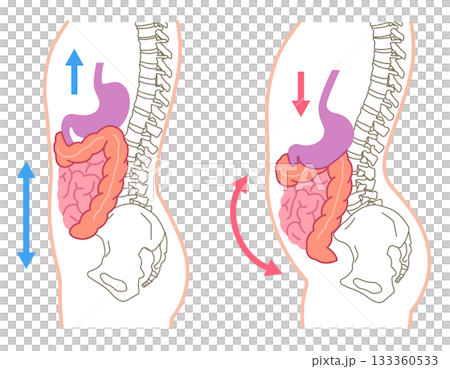 Visceroptosis: A condition in which the internal organs are lowered Visceroptosis: A condition in which the internal organs are lowered 133360533