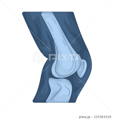 Illustration of knee x-ray  133363529