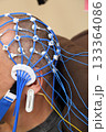 Electroencephalography (EEG) procedure. A noninvasive medical test that measures the brain's electrical activity. Electroencephalography (EEG) procedure. A noninvasive medical test that measures the brain's electrical activity. 133364086