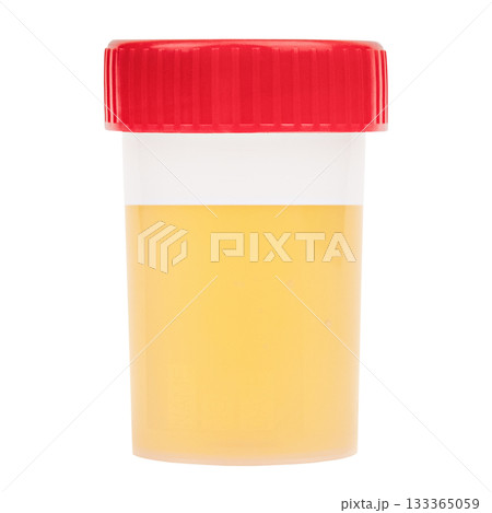 Urine test container isolated on white background Urine test container isolated on white background 133365059