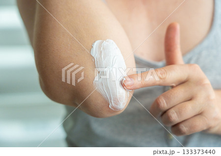 Cream on elbow skin. Applying the lotion to dry rough hands skin, elbow moisturizing creme Cream on elbow skin. Applying the lotion to dry rough hands skin, elbow moisturizing creme 133373440